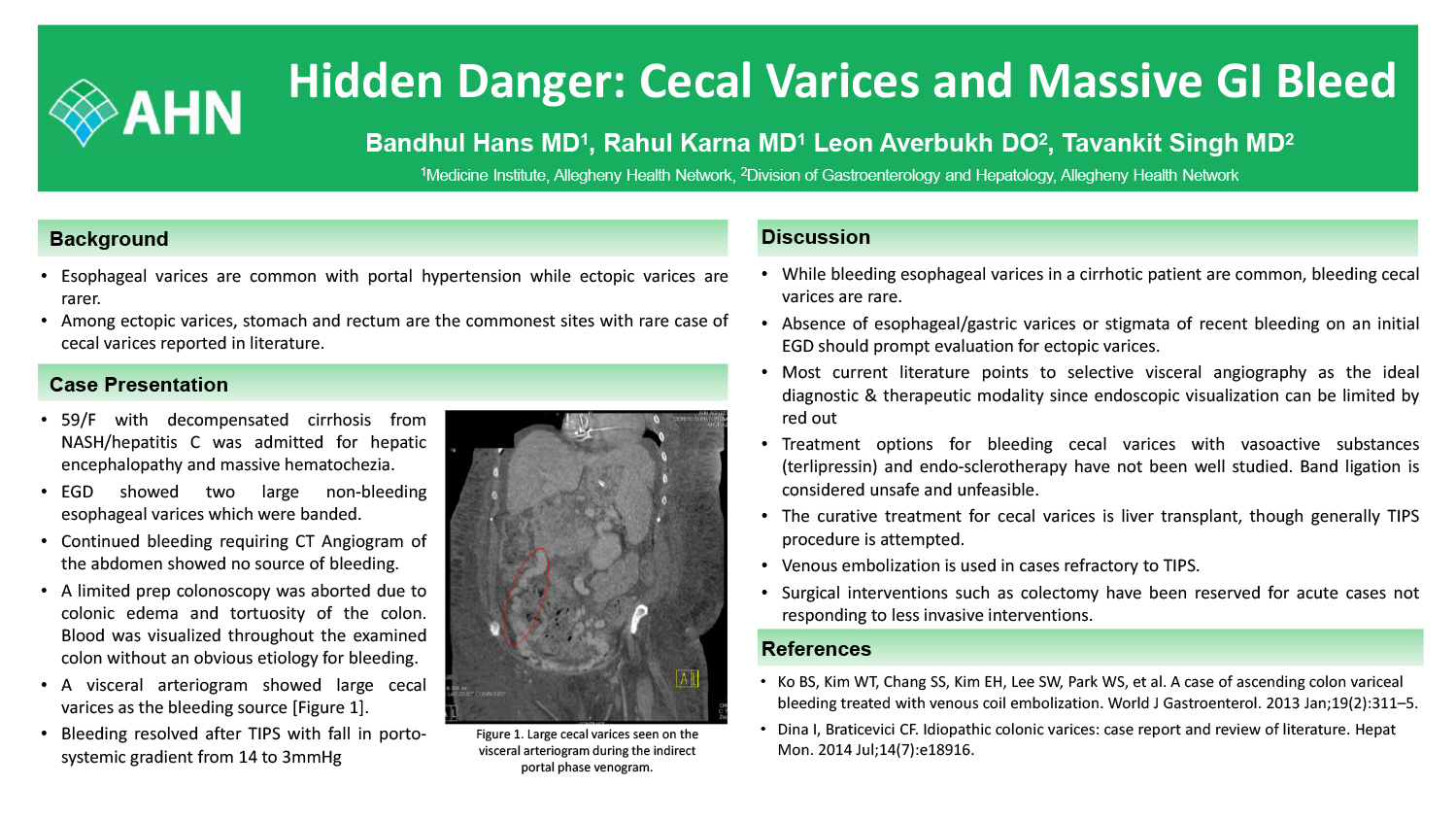 Bandhul Hans - PAW-9-Hidden-danger-cecal-varices-and-massive-GI-bleed