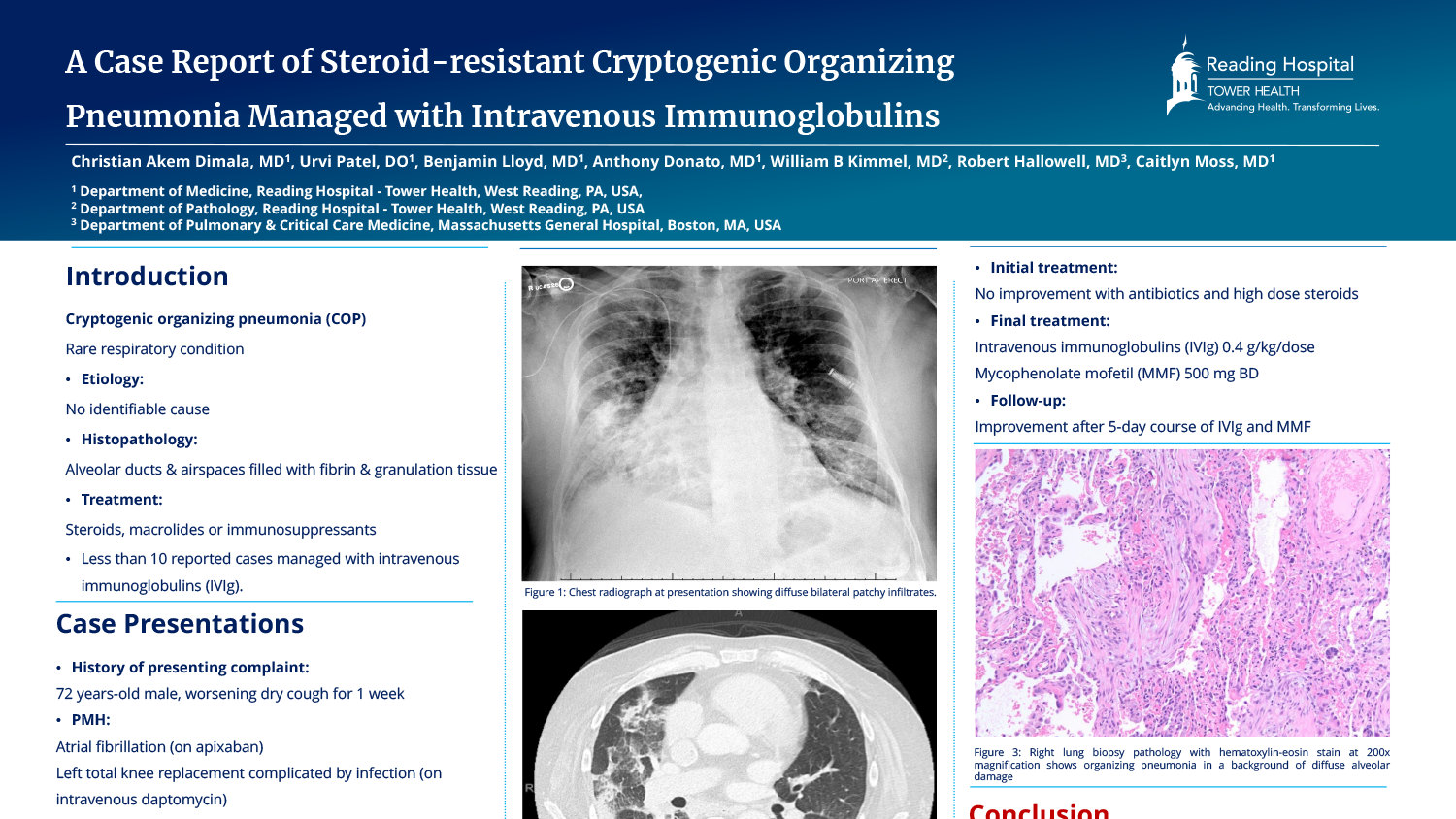 Christian Akem Dimala - PAE-14-A-Case-Report-of-Steroid-resistant-Cryptogenic-Organizing-Pneumonia-Managed-with-Intravenous-Immunoglobulins