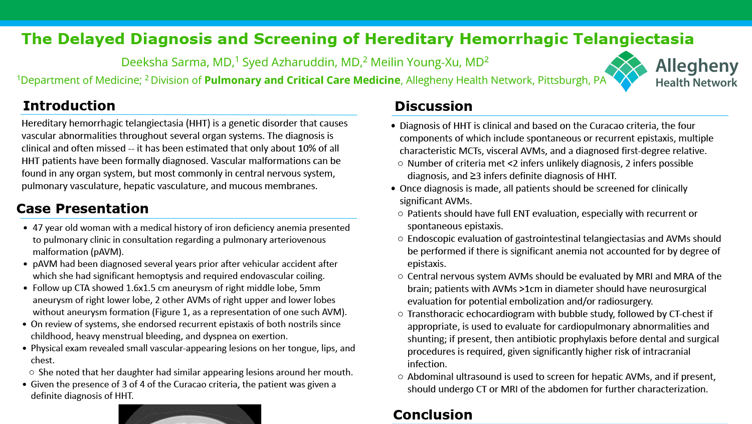 Deeksha Sarma - PAW-13-The-Delayed-Diagnosis-and-Screening-of-Hereditary-Hemorrhagic-Telangiectasia