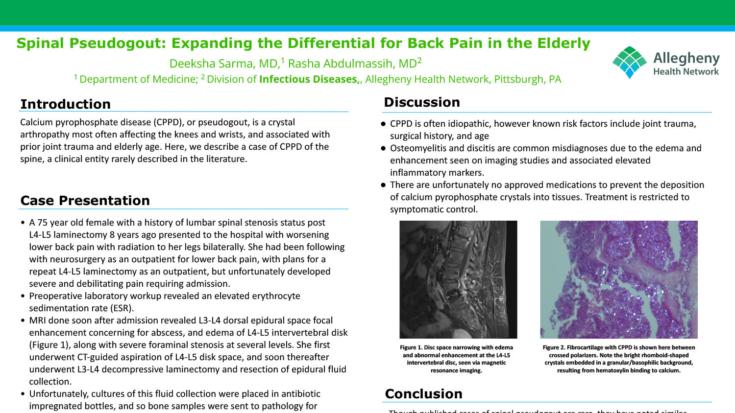 Deeksha Sarma - PAW-15-Spinal-Pseudogout-Expanding-the-Differential-for-Back-Pain-in-the-Elderly