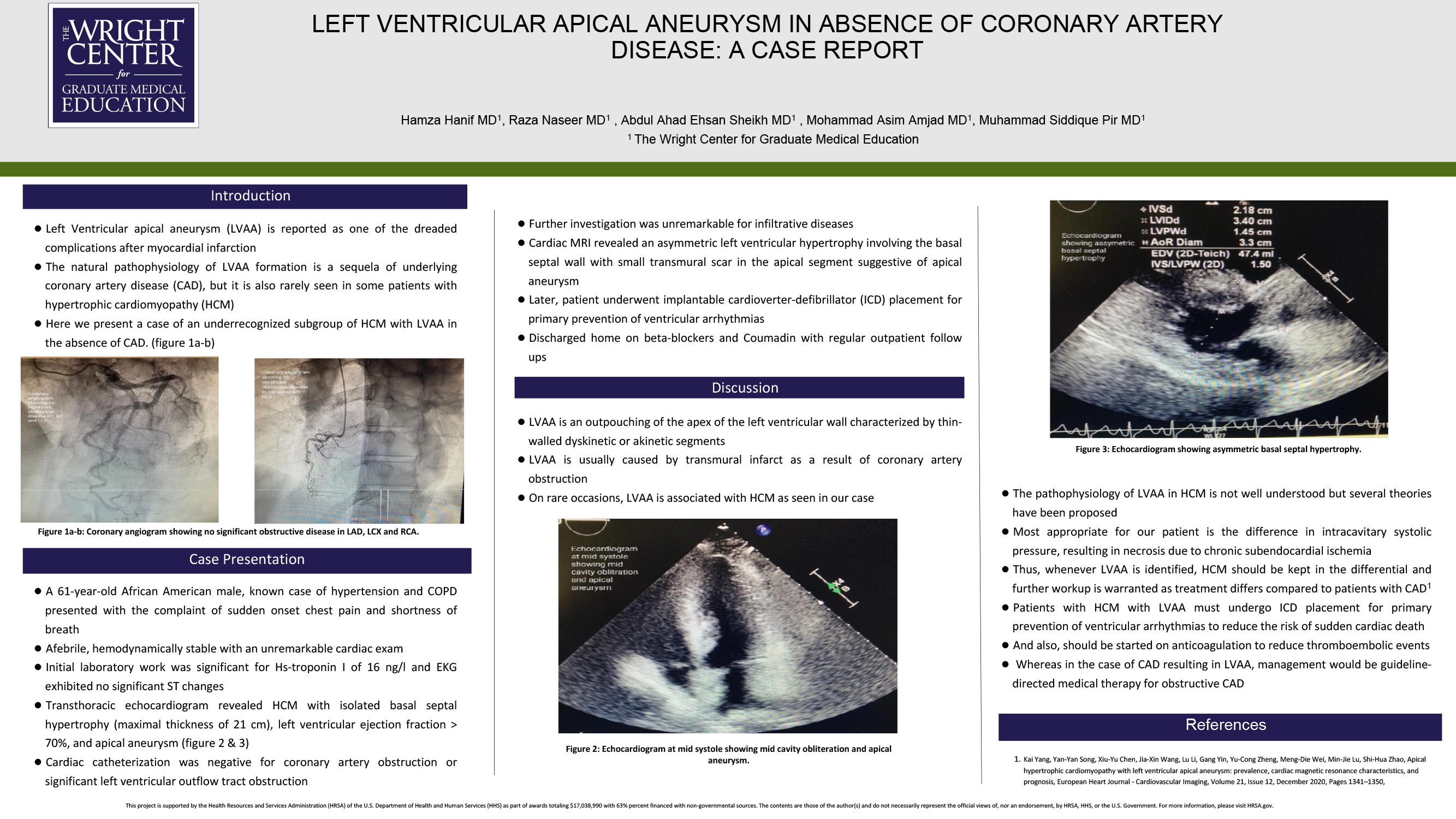HAMZA HANIF - PAE-19-LEFT-VENTRICULAR-APICAL-ANEURYSM-IN-ABSENCE-OF-CORONARY-ARTERY-DISEASE-A-CASE-REPORT_