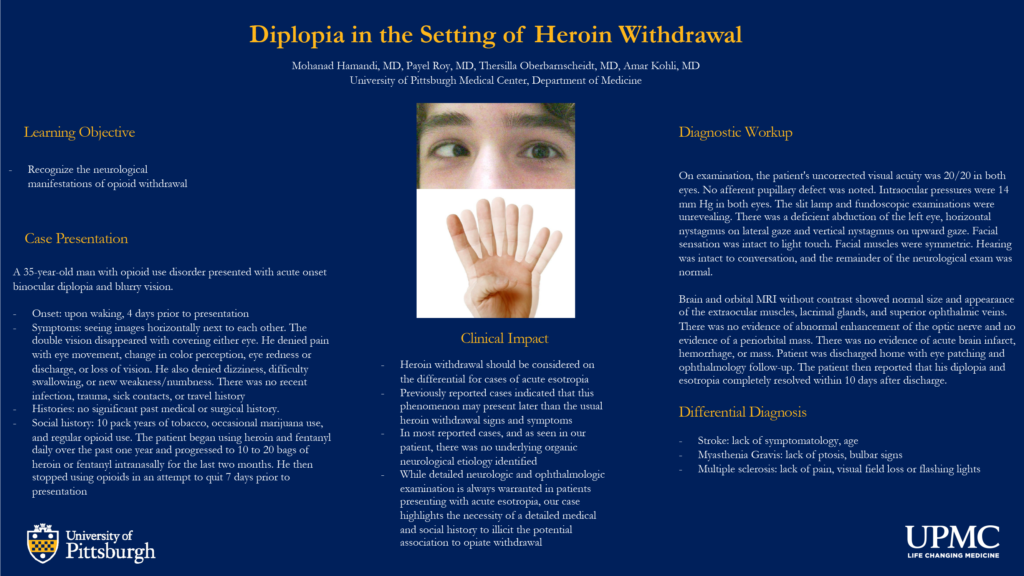 Mohanad Hamandi - PAW-33-Diplopia-in-the-setting-of-heroin-withdrawal V2