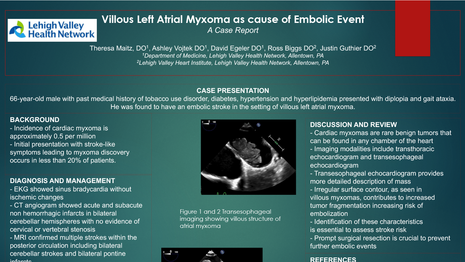 PAE-48-Villous Left Atrial Myxoma as cause of Embolic Event