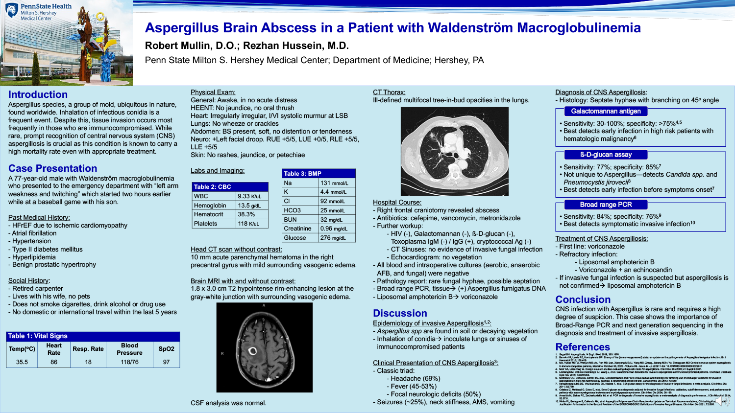 Robert Mullin - 2021-10-11 00.01.31 - PAE-34-Aspergillus-Brain-Abscess-in-a-patient-with-Waldenstrom-Macroglobulinemia