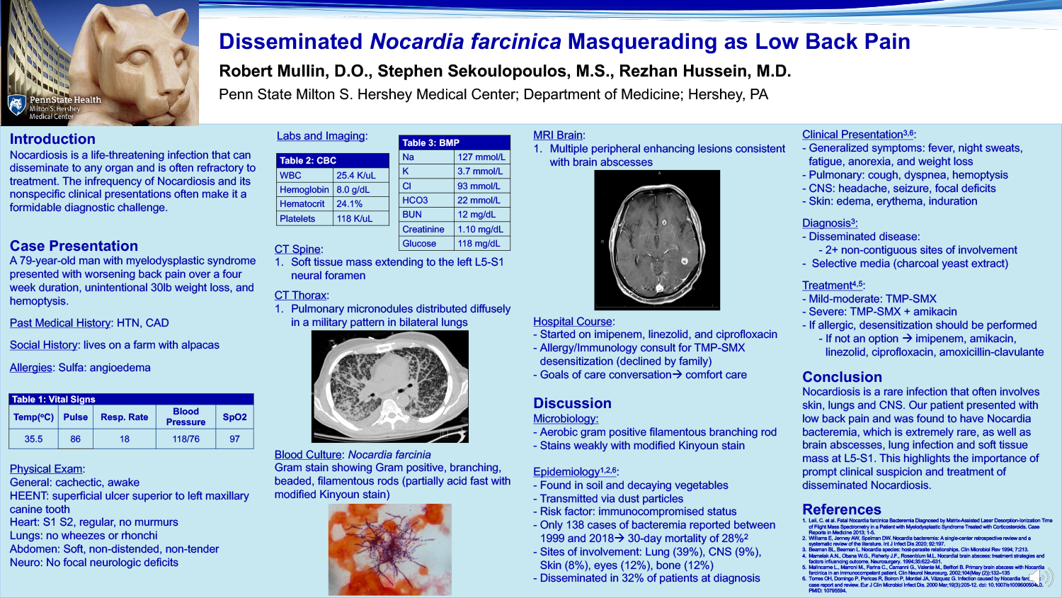 Robert Mullin - PAE-42-Disseminated-Nocardia-farcinica Masquerading-as-Low-Back-Pain
