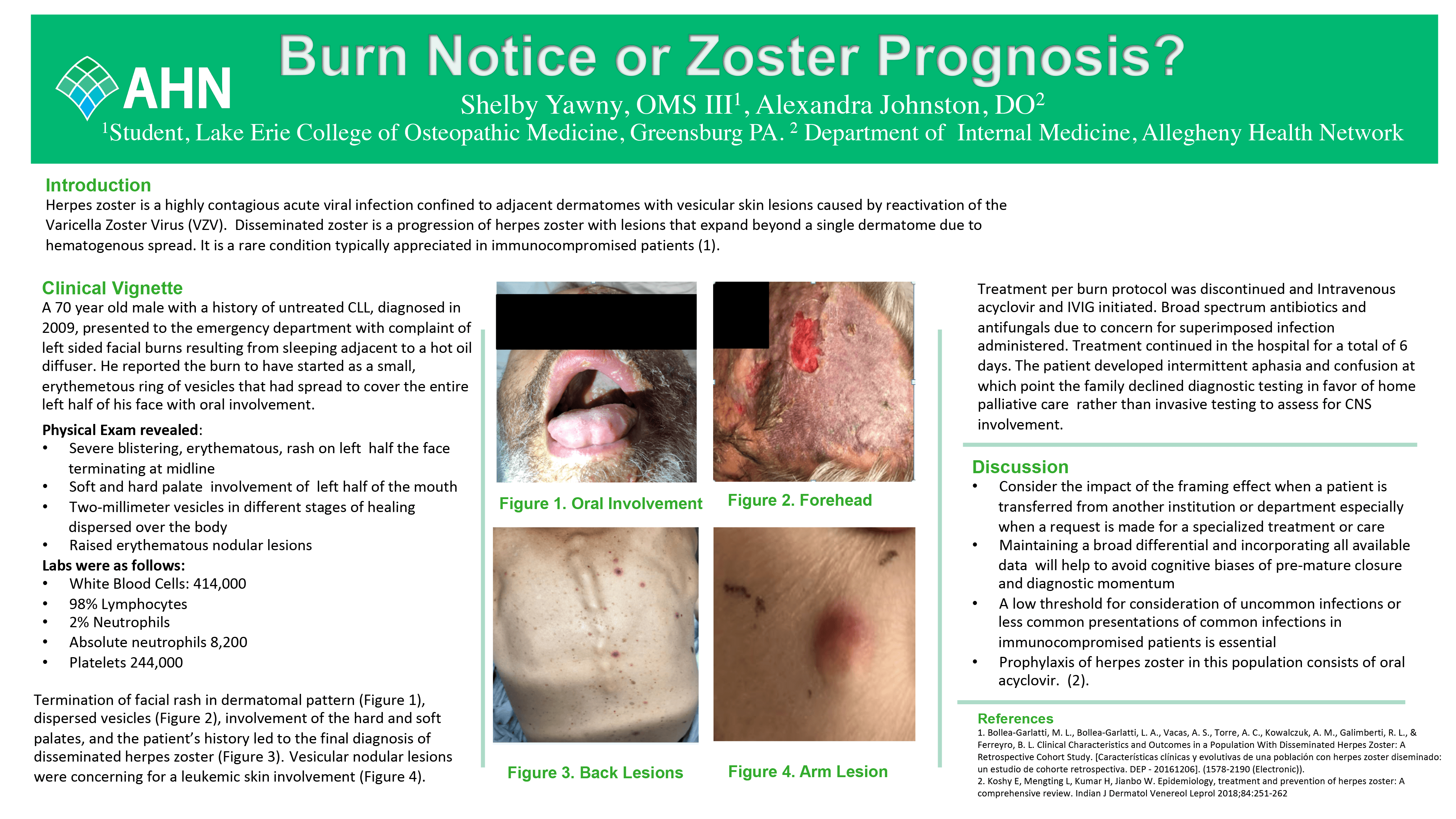 Shelby Yawny - PAW-40-Burn-Notice-Or-Zoster-Prognosis