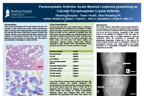 CE-30_Shrestha_Paraneoplastic Arthritis Manish