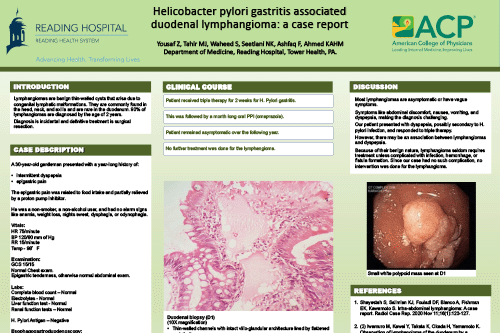 CSE-13-_Yousaf_Zohaib_Helicobacter pylori gastritis associated duodenal lymphoma Zohaib Yousaf